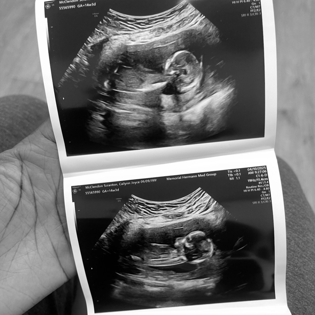 Photo shared by Cailynn for their Babylist baby registry.