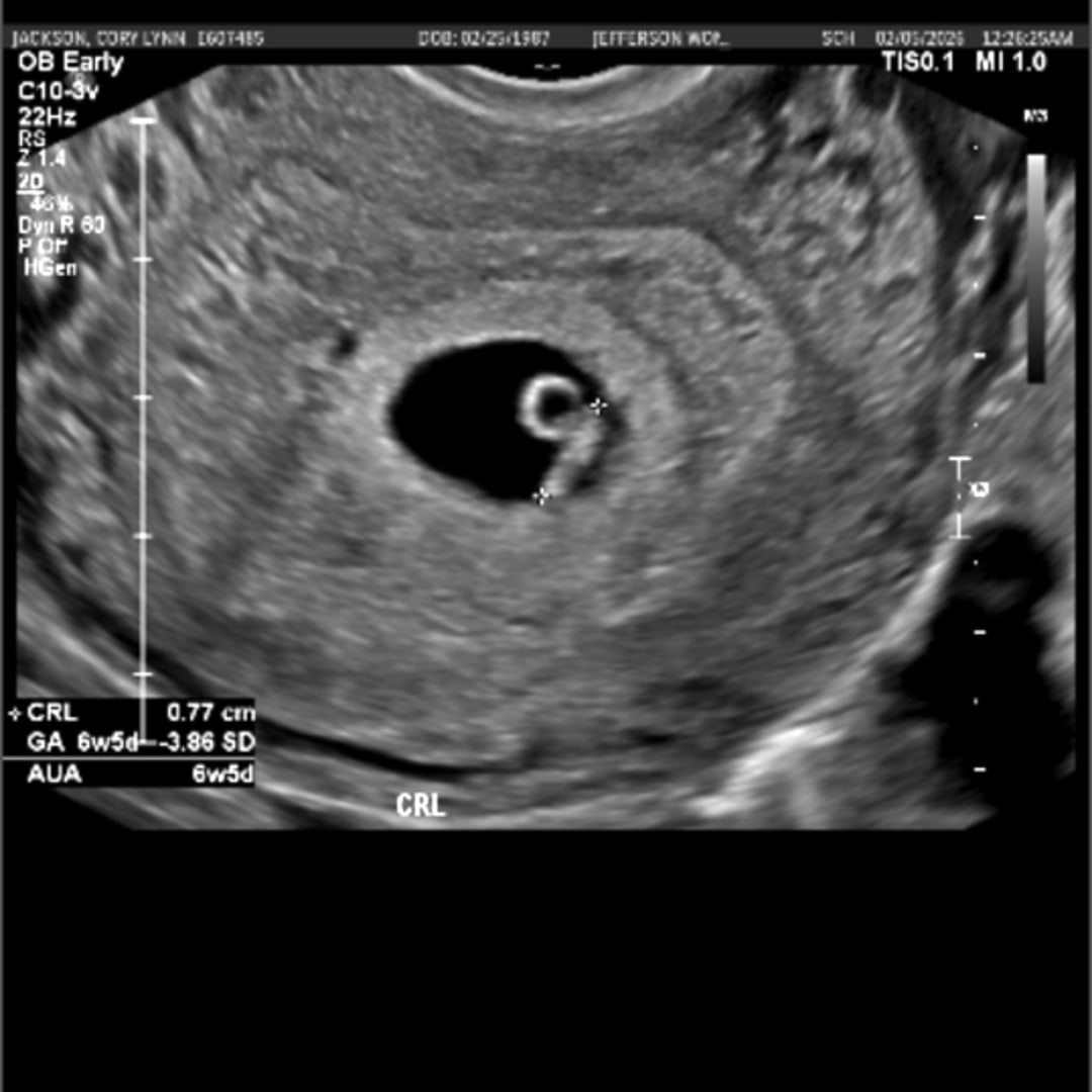 Photo shared by Cory Lynn for their Babylist baby registry.