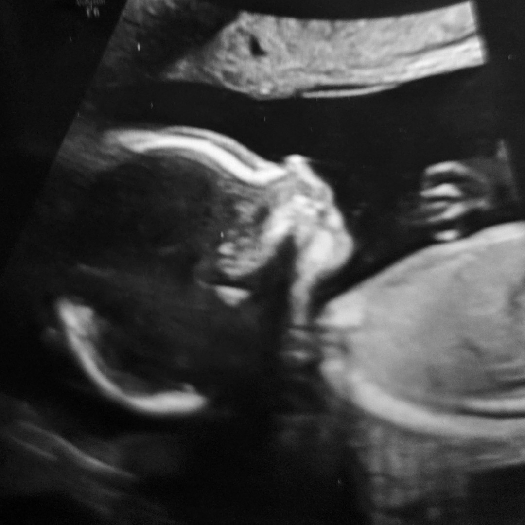 Photo shared by Arielle for their Babylist baby registry.