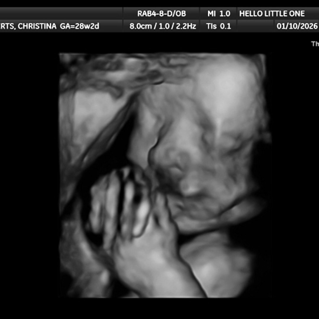 Photo shared by Christina for their Babylist baby registry.