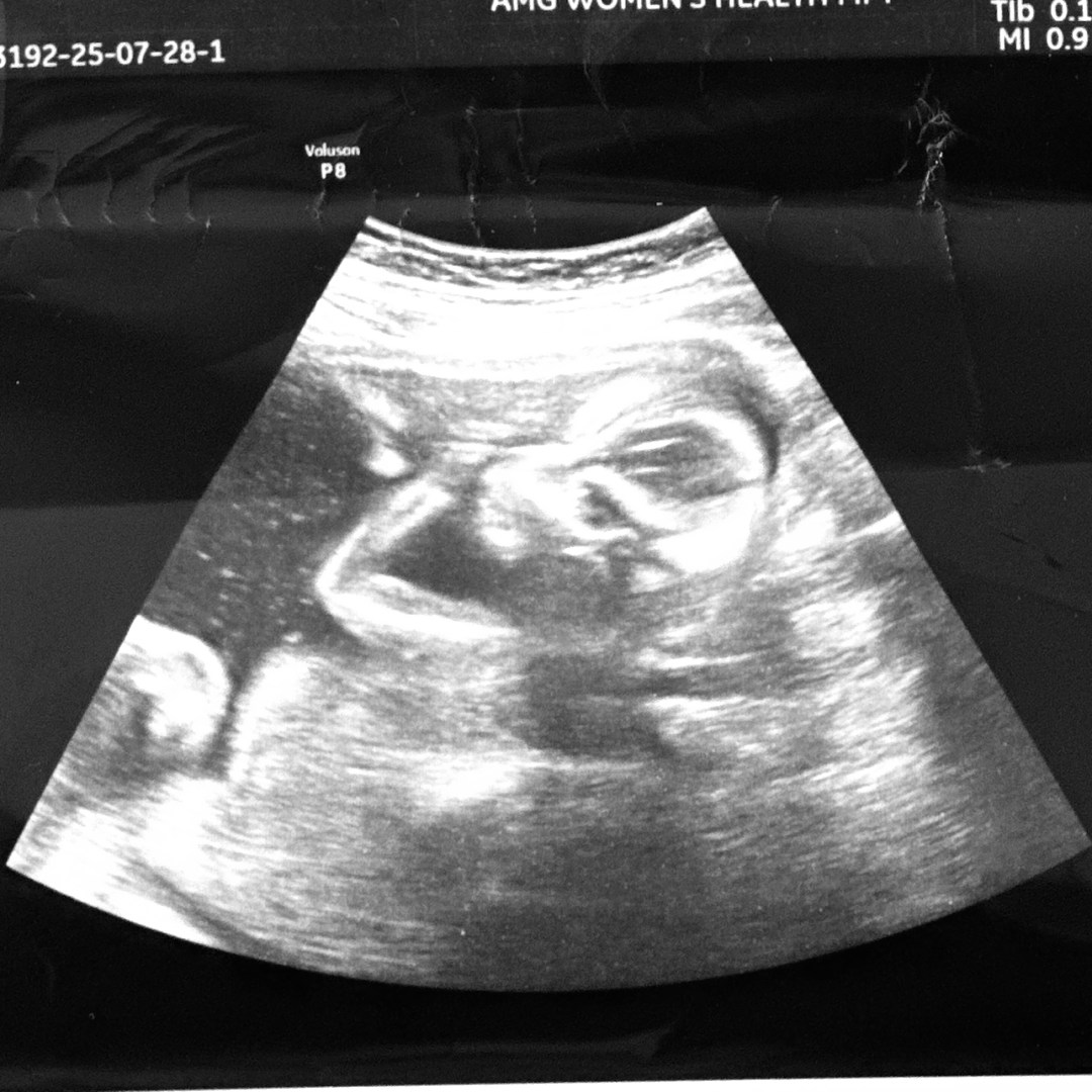 Photo shared by Briana for their Babylist baby registry.