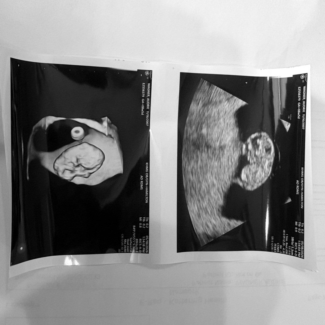 Photo shared by Audrie for their Babylist baby registry.