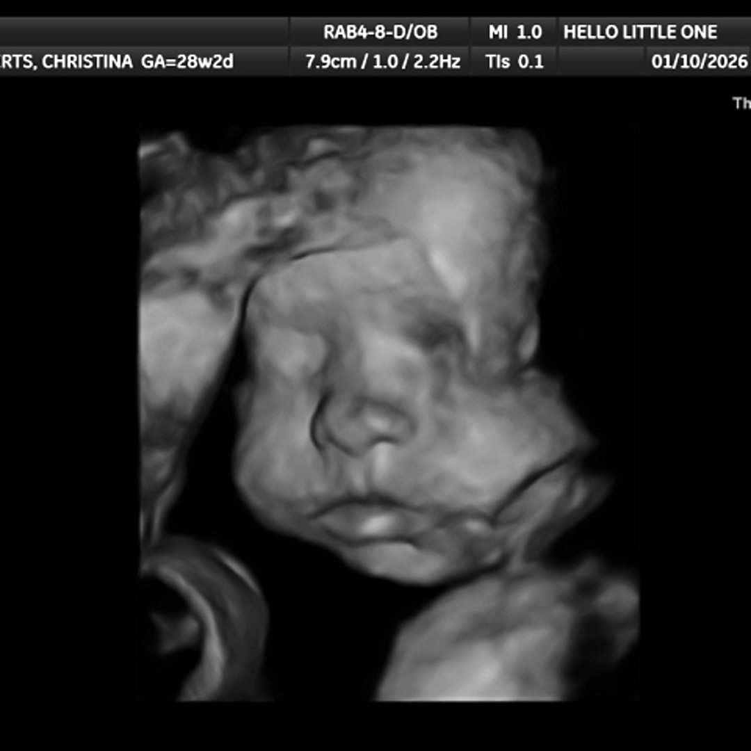 Photo shared by Christina for their Babylist baby registry.