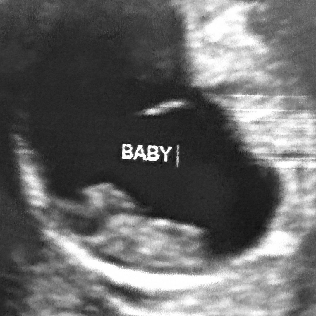 Photo shared by Dorothy for their Babylist baby registry.