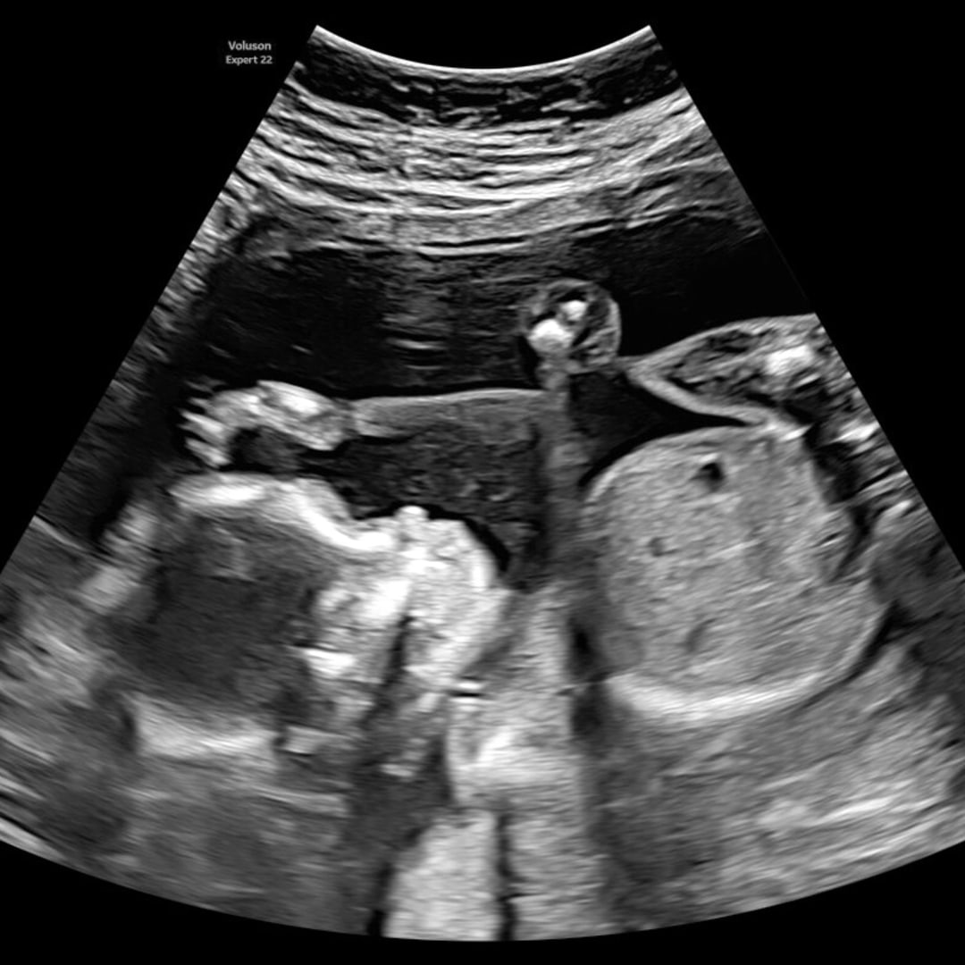 Photo shared by Alesa for their Babylist baby registry.