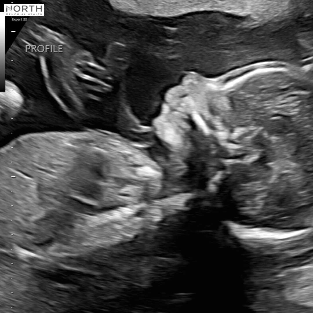 Photo shared by Sara for their Babylist baby registry.