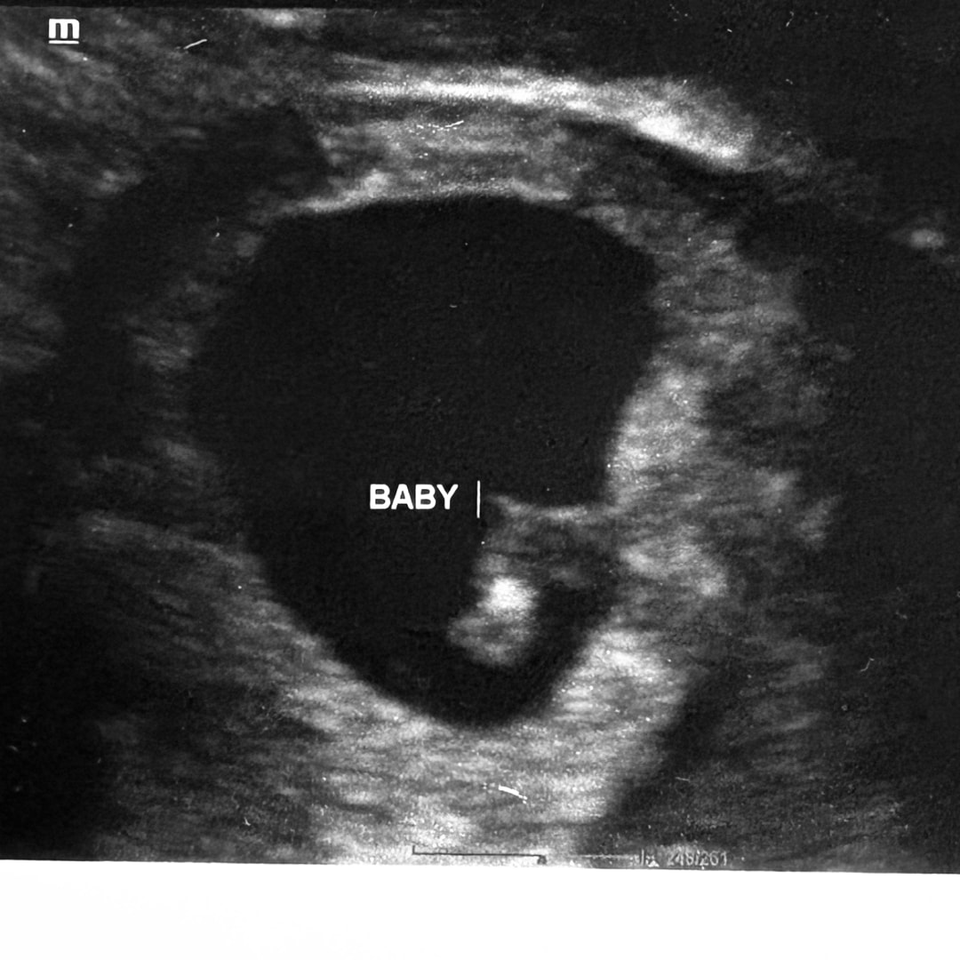 Photo shared by Abbi for their Babylist baby registry.
