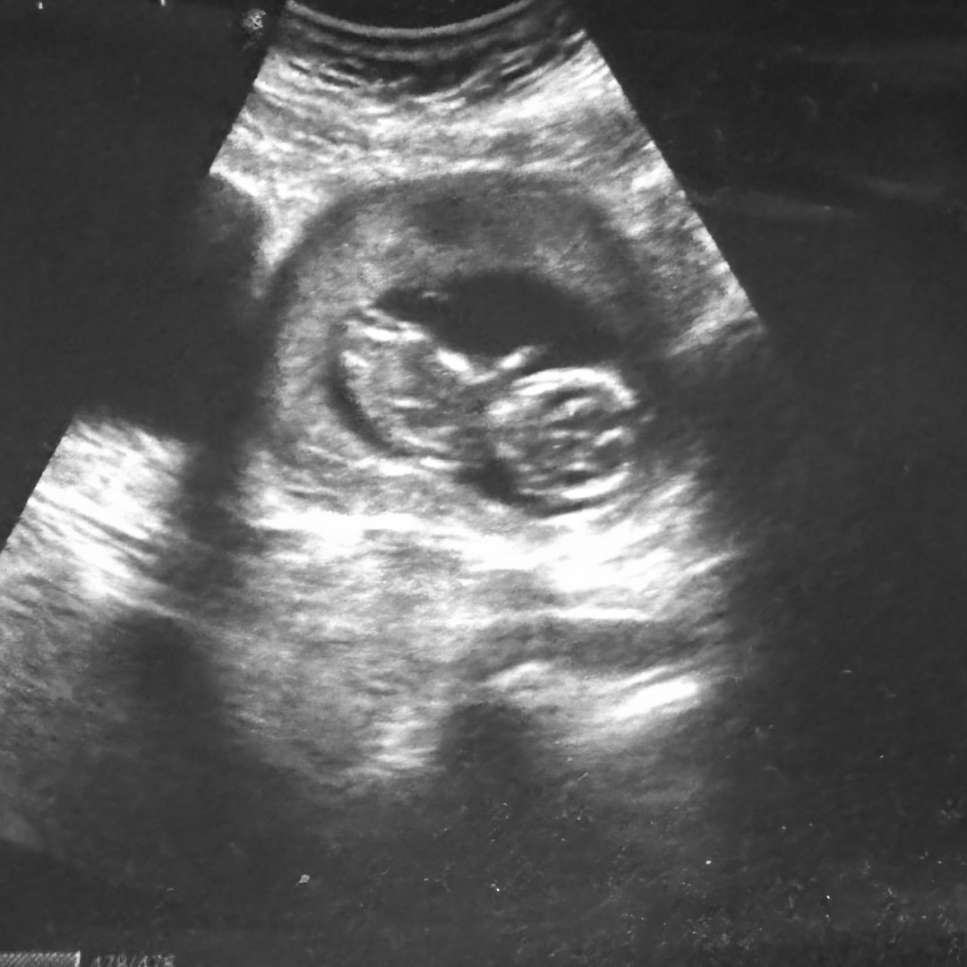 Photo shared by Jasmine for their Babylist baby registry.