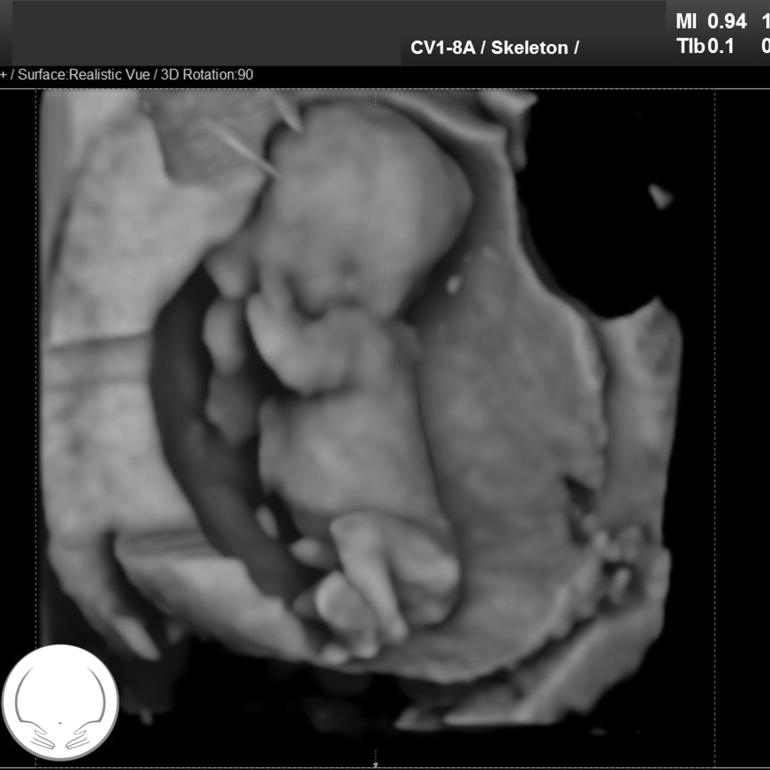 Photo shared by Jade for their Babylist baby registry.