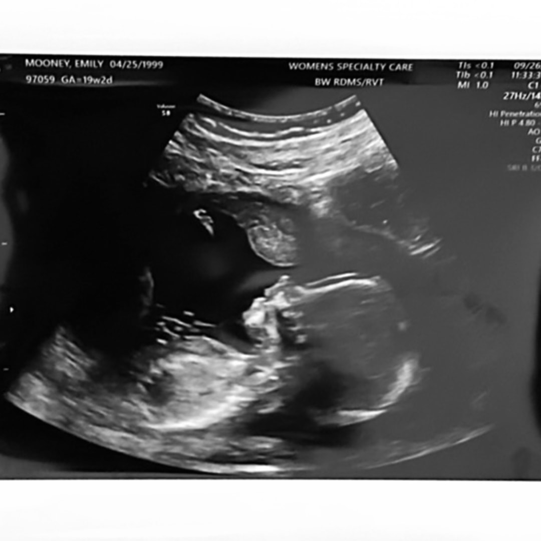 Photo shared by Emily for their Babylist baby registry.