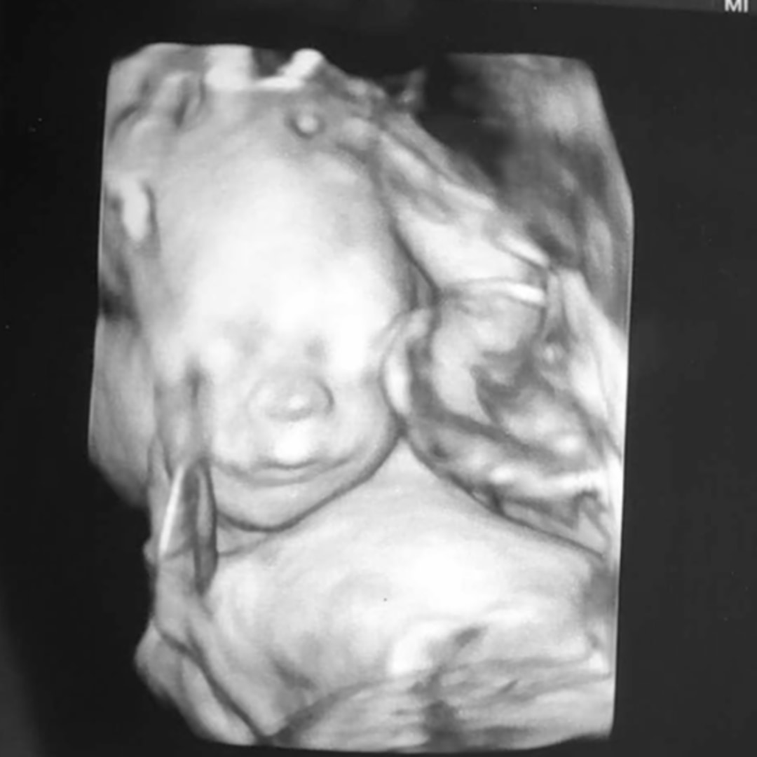 Photo shared by Alyssa for their Babylist baby registry.