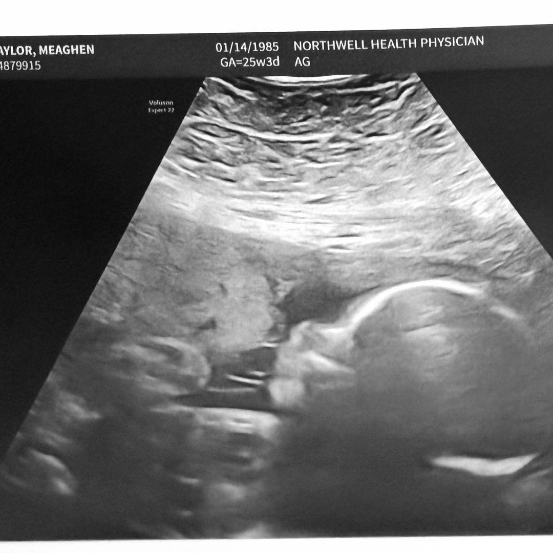 Photo shared by Meaghen for their Babylist baby registry.