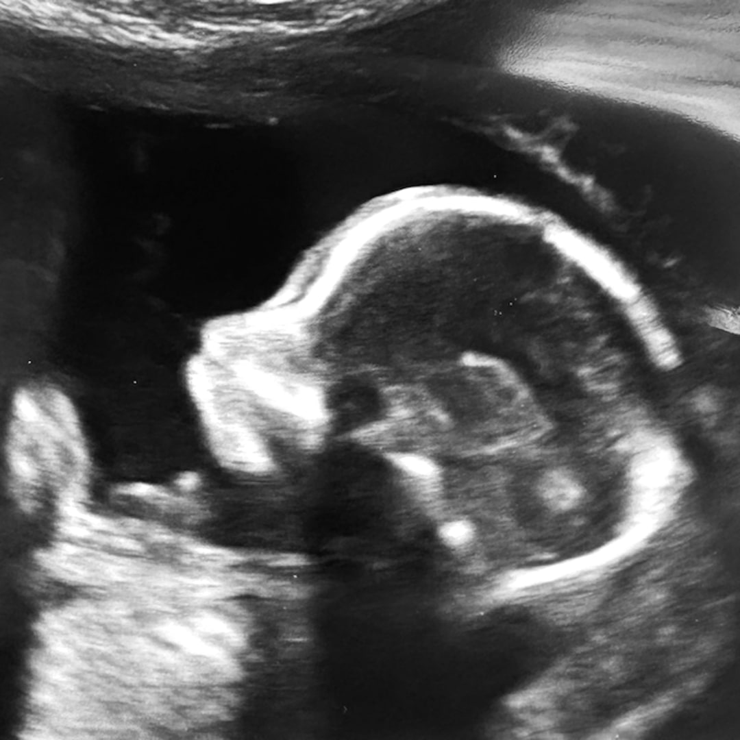 Photo shared by Bethany for their Babylist baby registry.