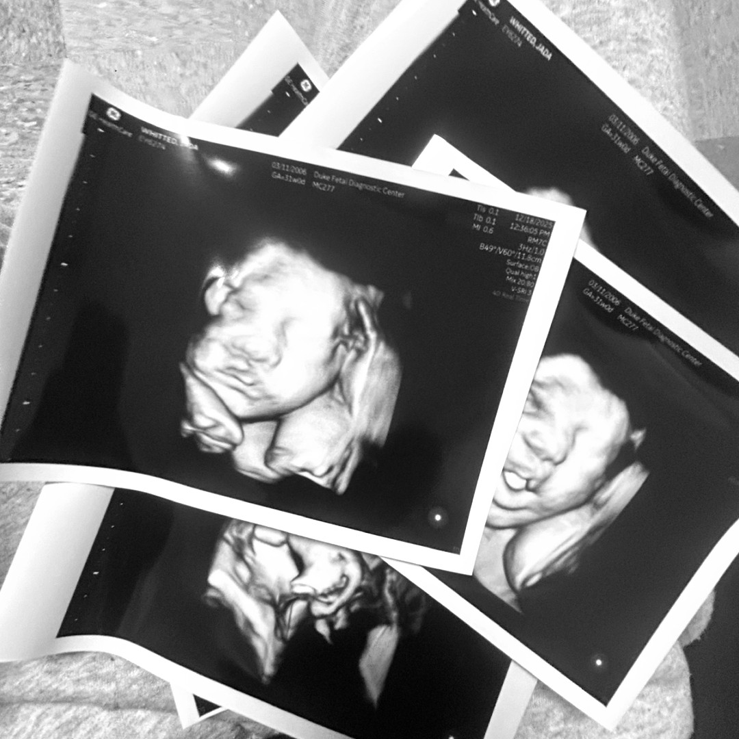 Photo shared by Jada for their Babylist baby registry.