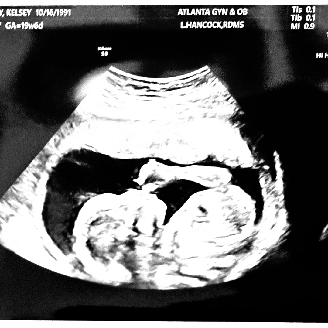 Photo shared by Kelsey for their Babylist baby registry.