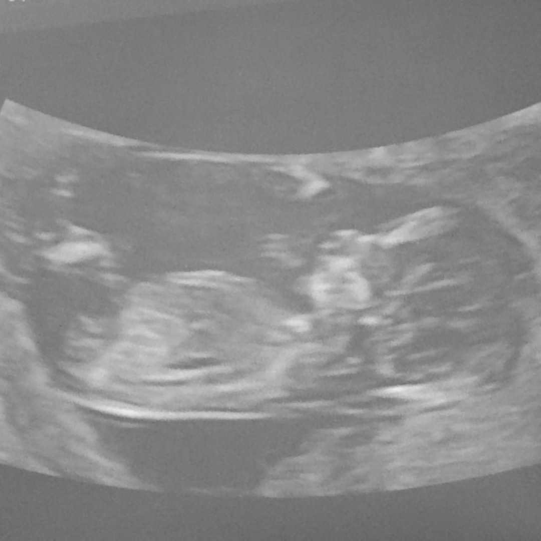 Photo shared by Mikaela for their Babylist baby registry.