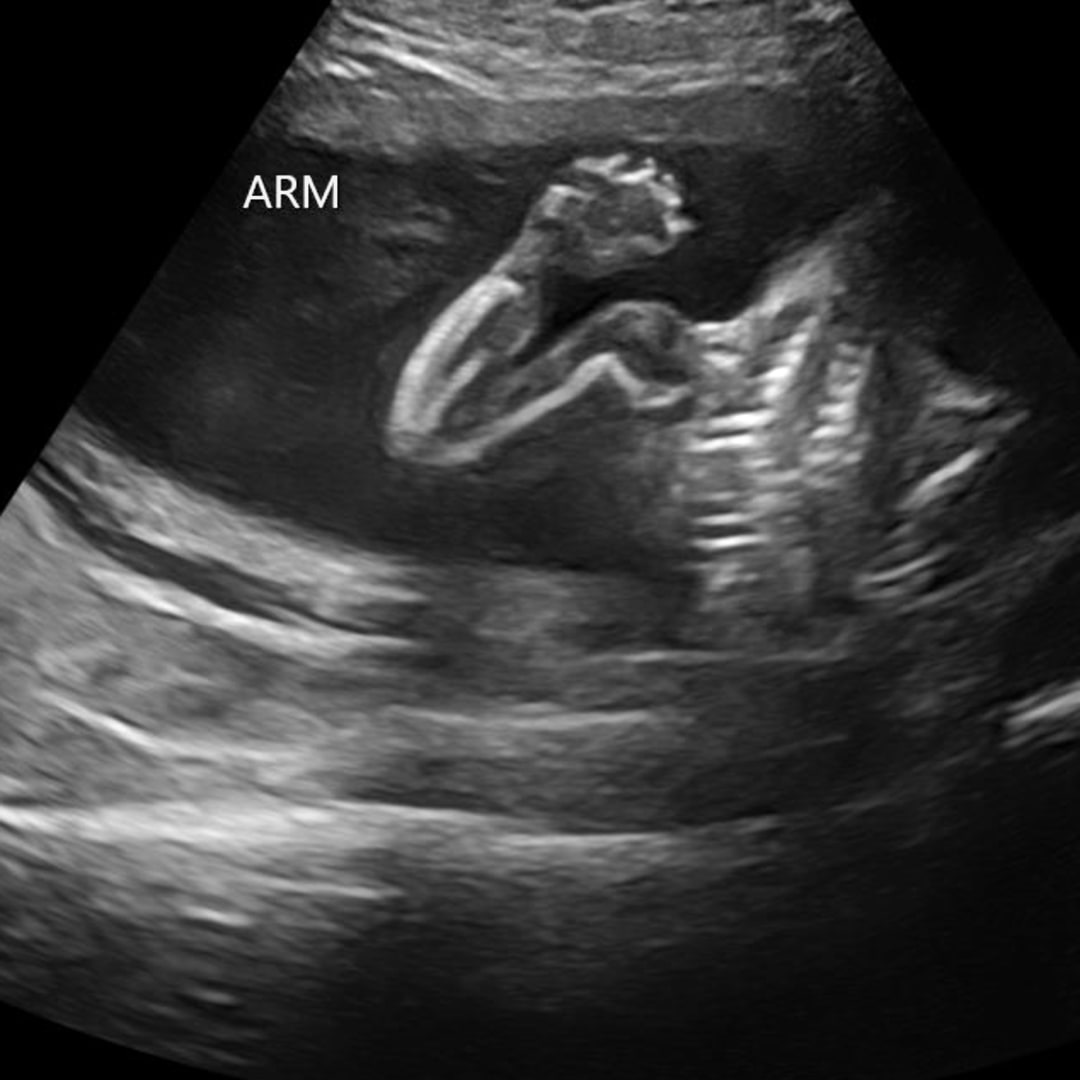 Photo shared by Gracie for their Babylist baby registry.