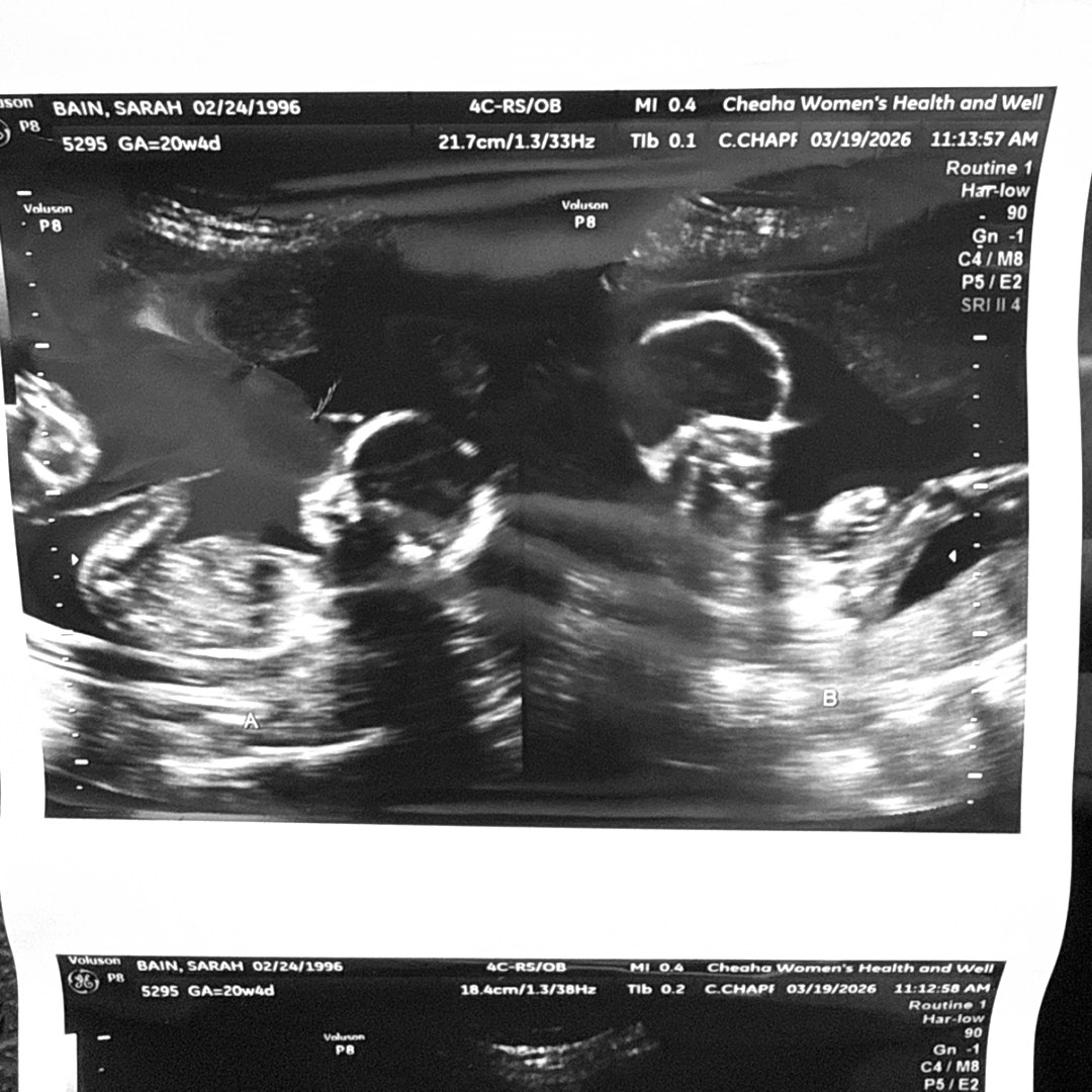 Photo shared by Sarah for their Babylist baby registry.