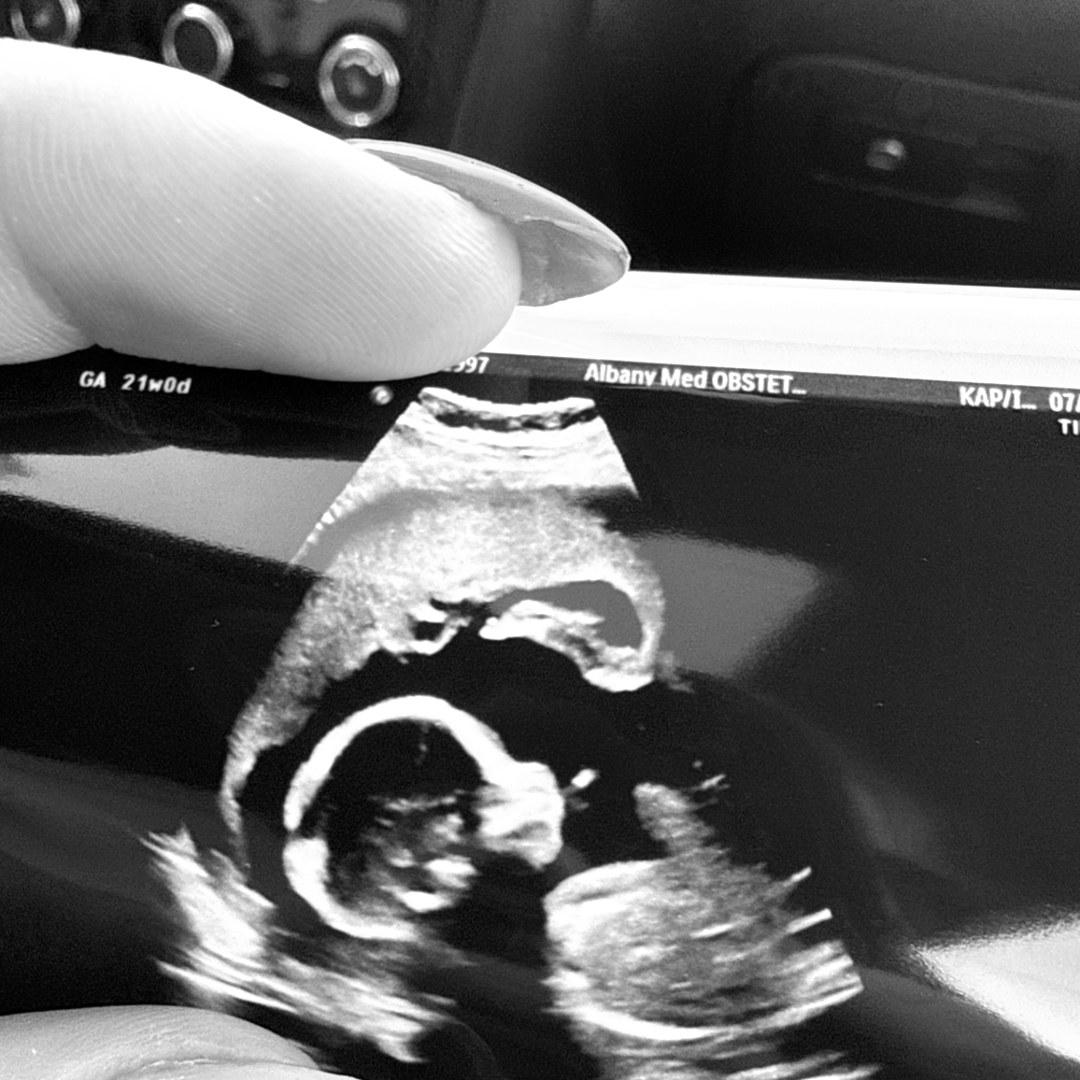 Photo shared by Sara for their Babylist baby registry.