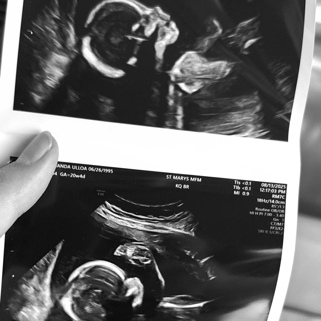 Photo shared by Amanda for their Babylist baby registry.