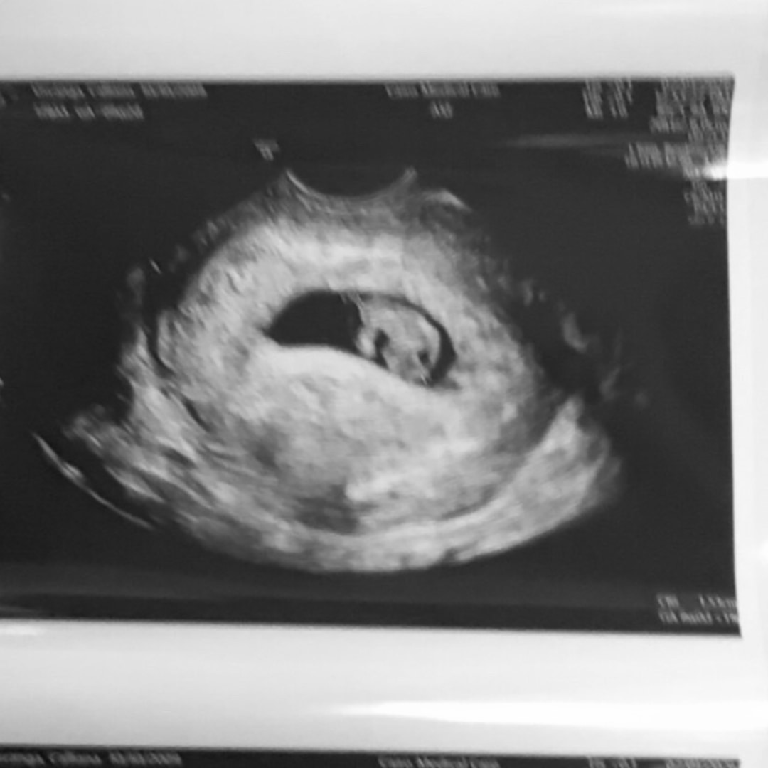 Photo shared by Calliana for their Babylist baby registry.