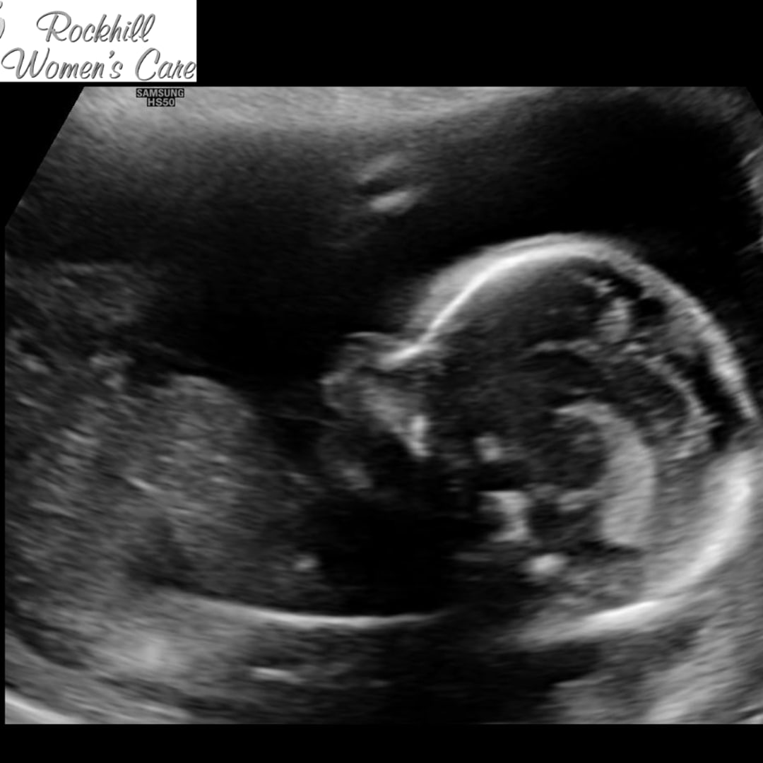 Photo shared by Mikayla for their Babylist baby registry.