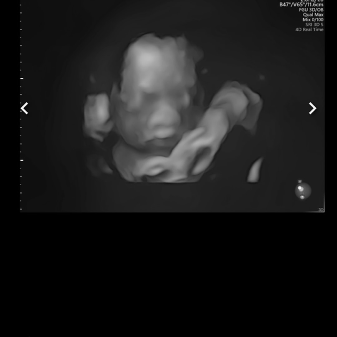 Photo shared by Autumn for their Babylist baby registry.