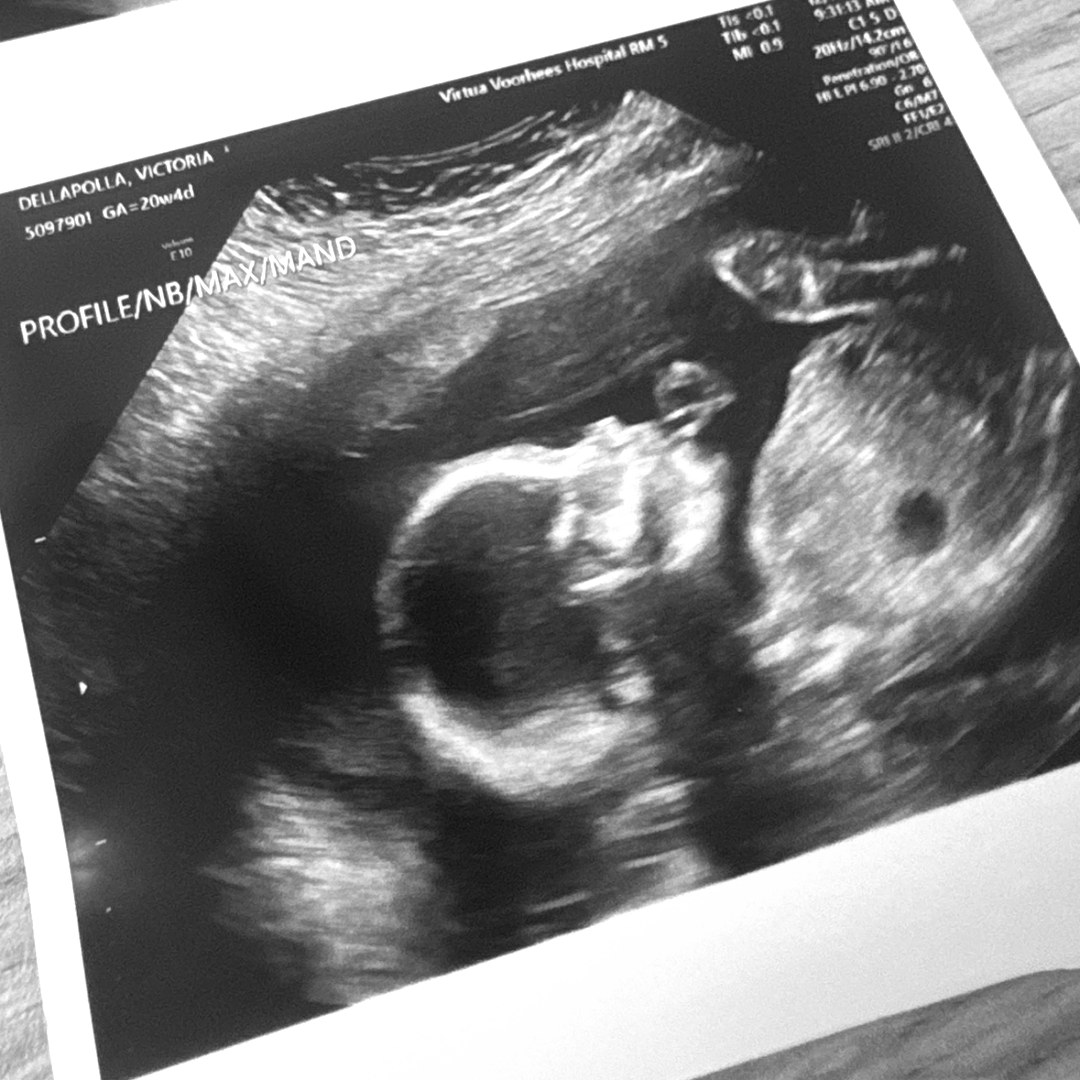 Photo shared by Tori for their Babylist baby registry.