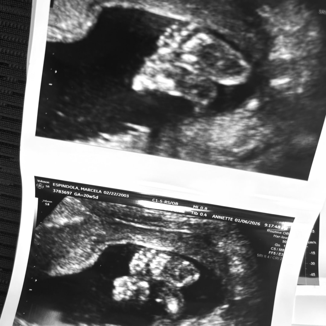 Photo shared by Marcela for their Babylist baby registry.