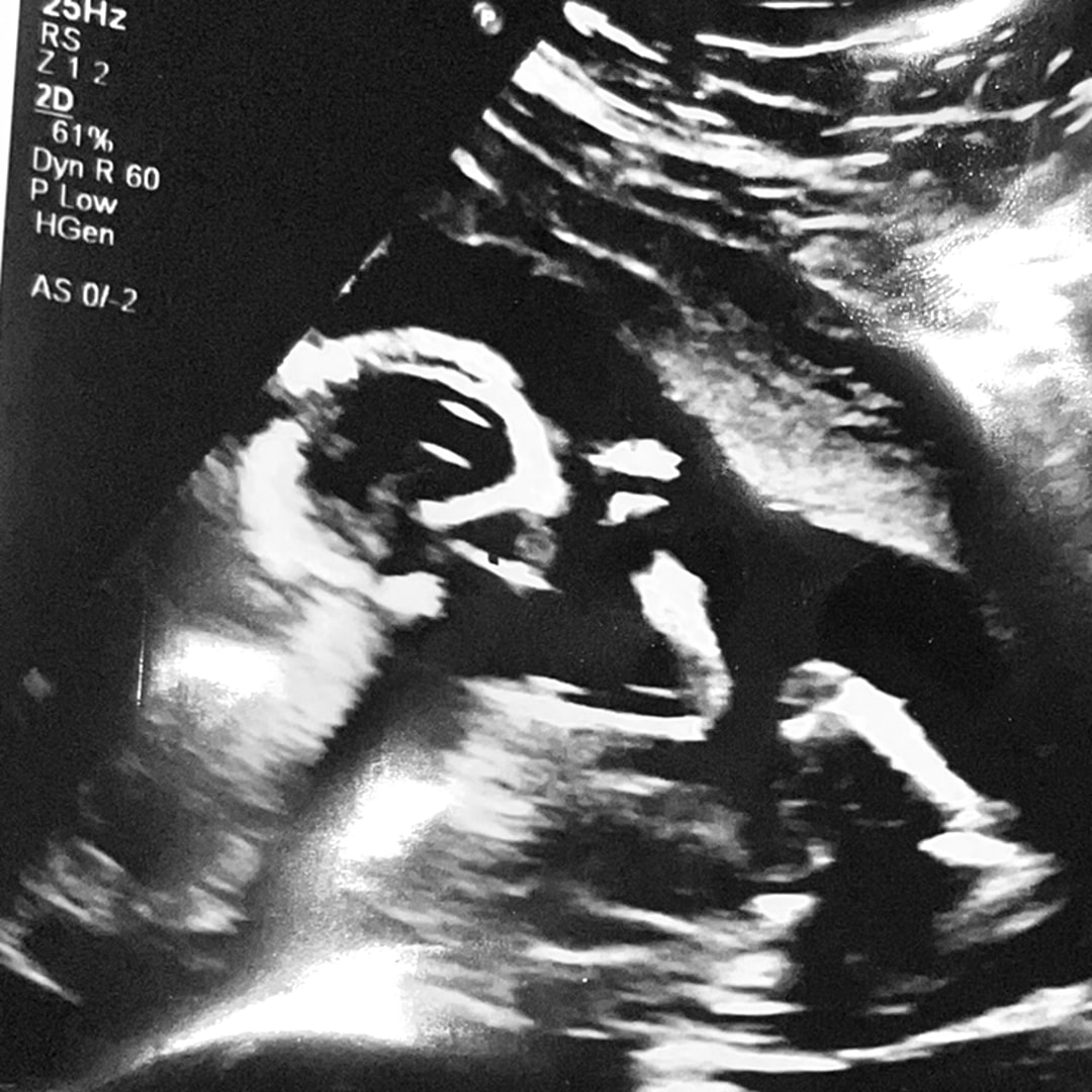 Photo shared by Samantha for their Babylist baby registry.