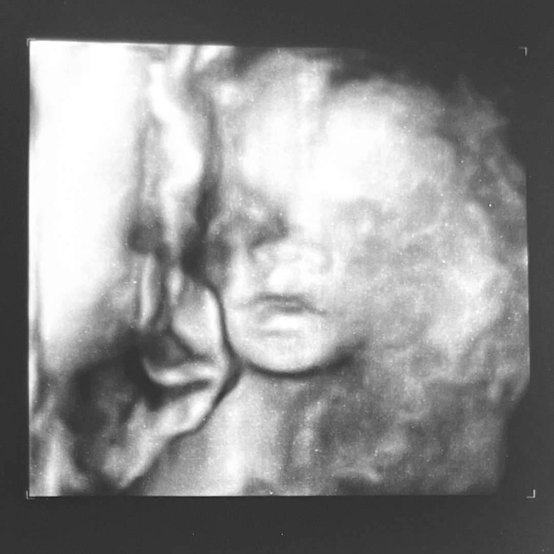 Photo shared by Kayla for their Babylist baby registry.