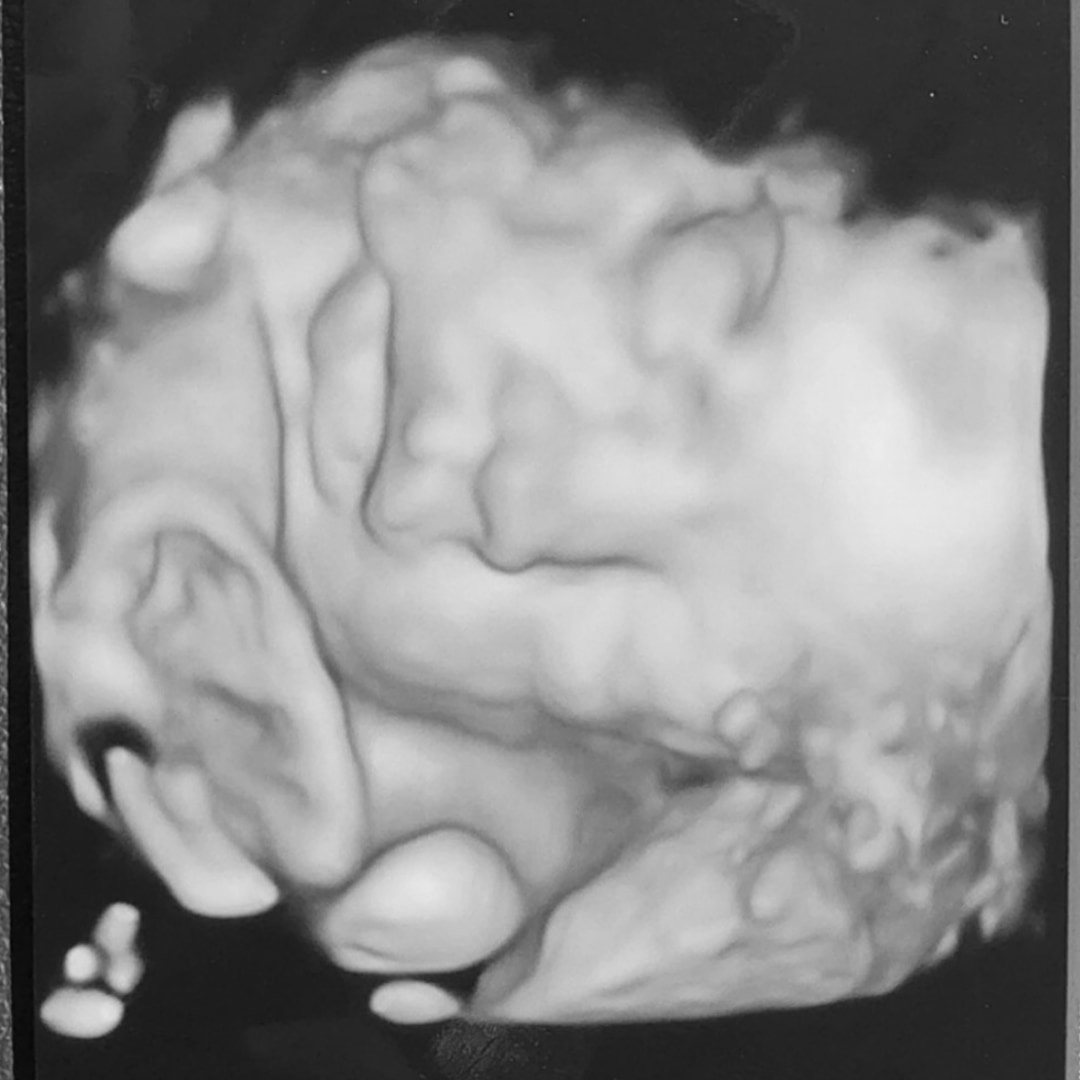 Photo shared by Mikayla for their Babylist baby registry.