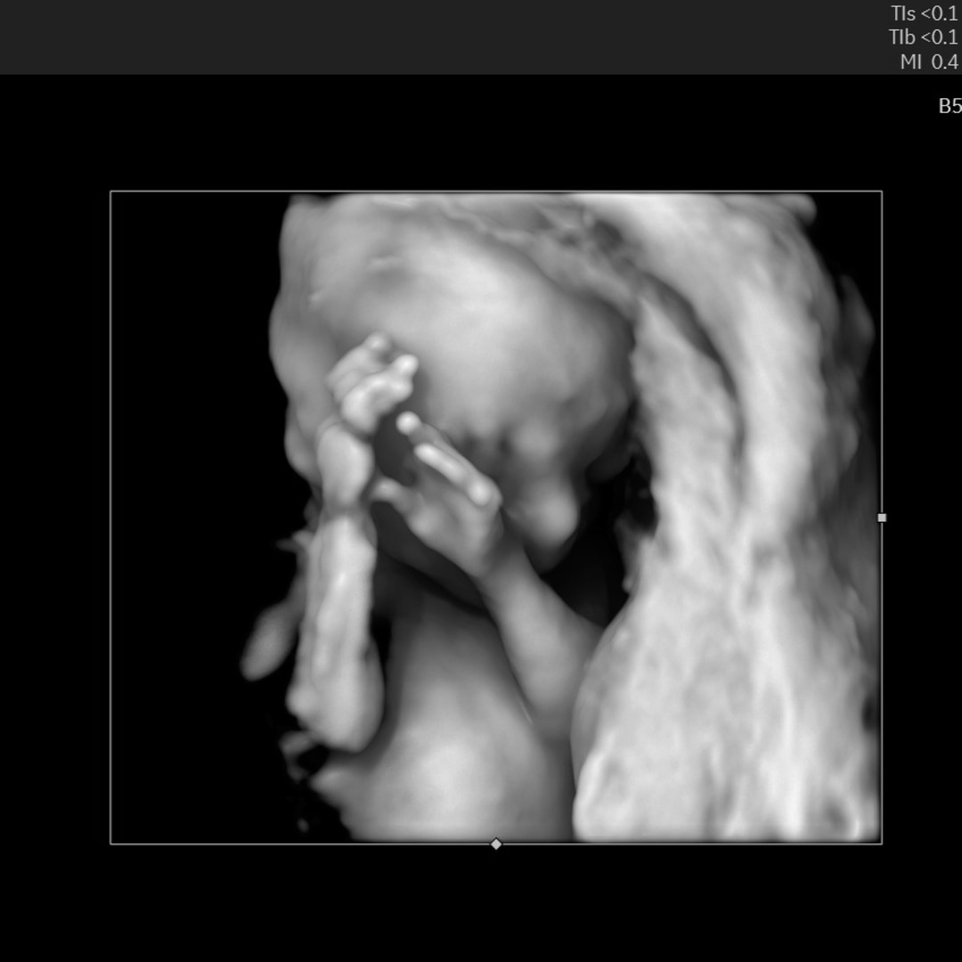 Photo shared by Deidra for their Babylist baby registry.