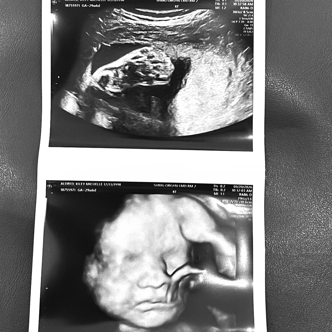 Photo shared by Kiley for their Babylist baby registry.