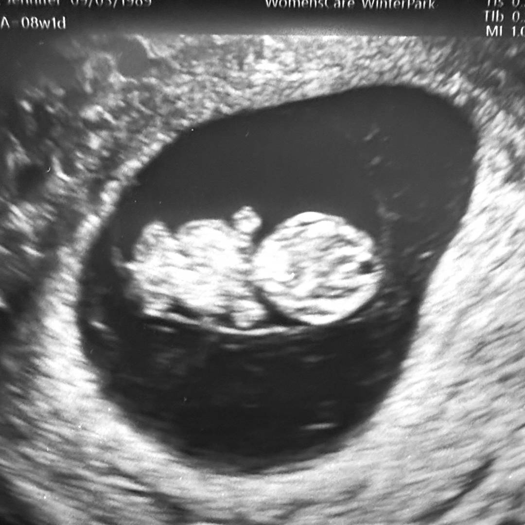 Photo shared by Jennifer for their Babylist baby registry.