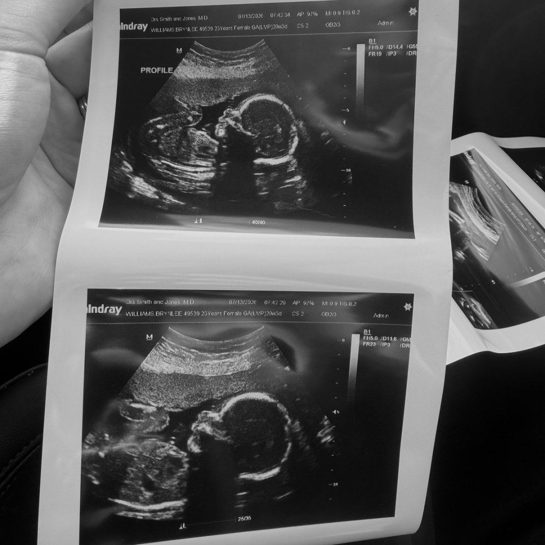 Photo shared by Brynlee for their Babylist baby registry.