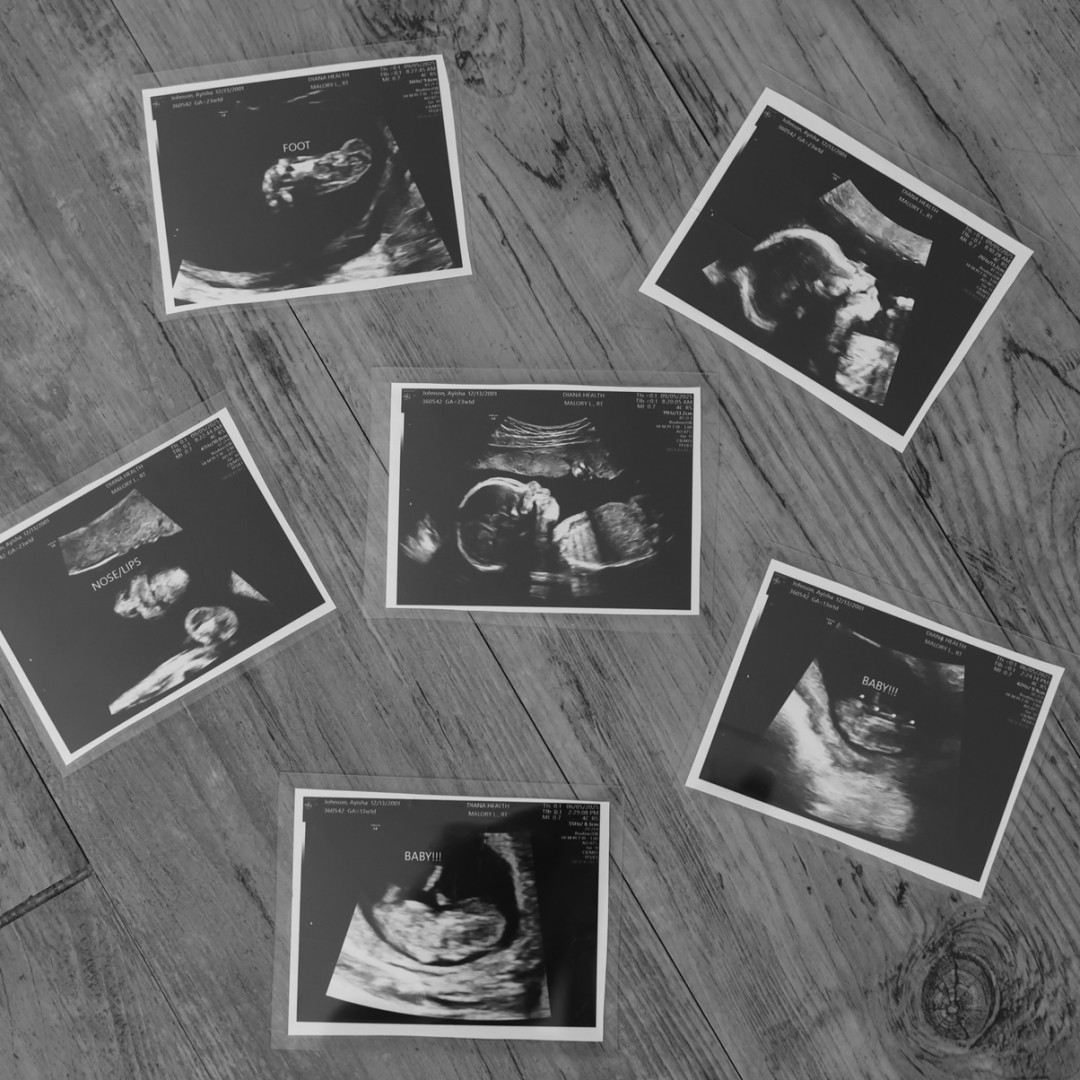 Photo shared by Ayisha for their Babylist baby registry.