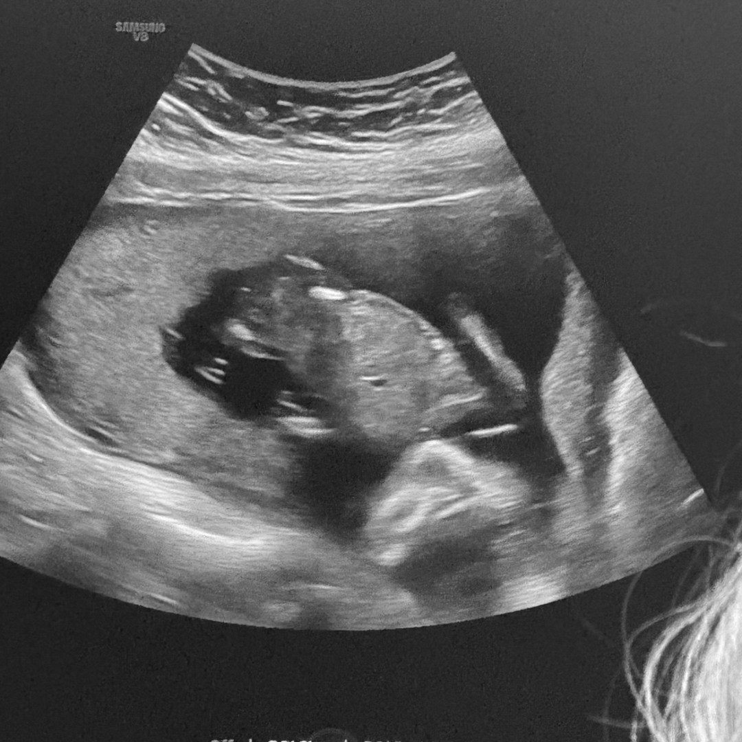 Photo shared by Bailey for their Babylist baby registry.