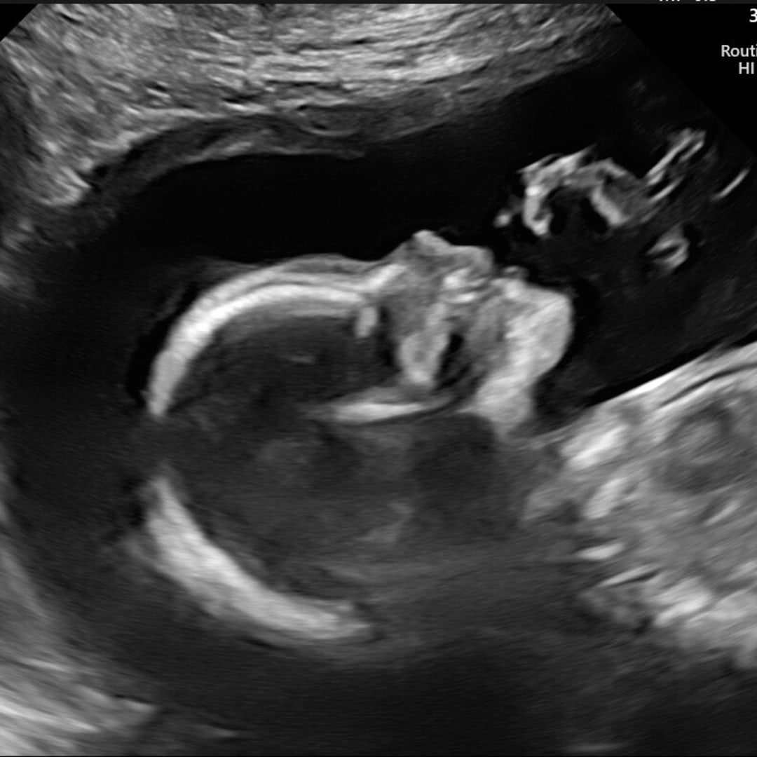 Photo shared by Barbara for their Babylist baby registry.