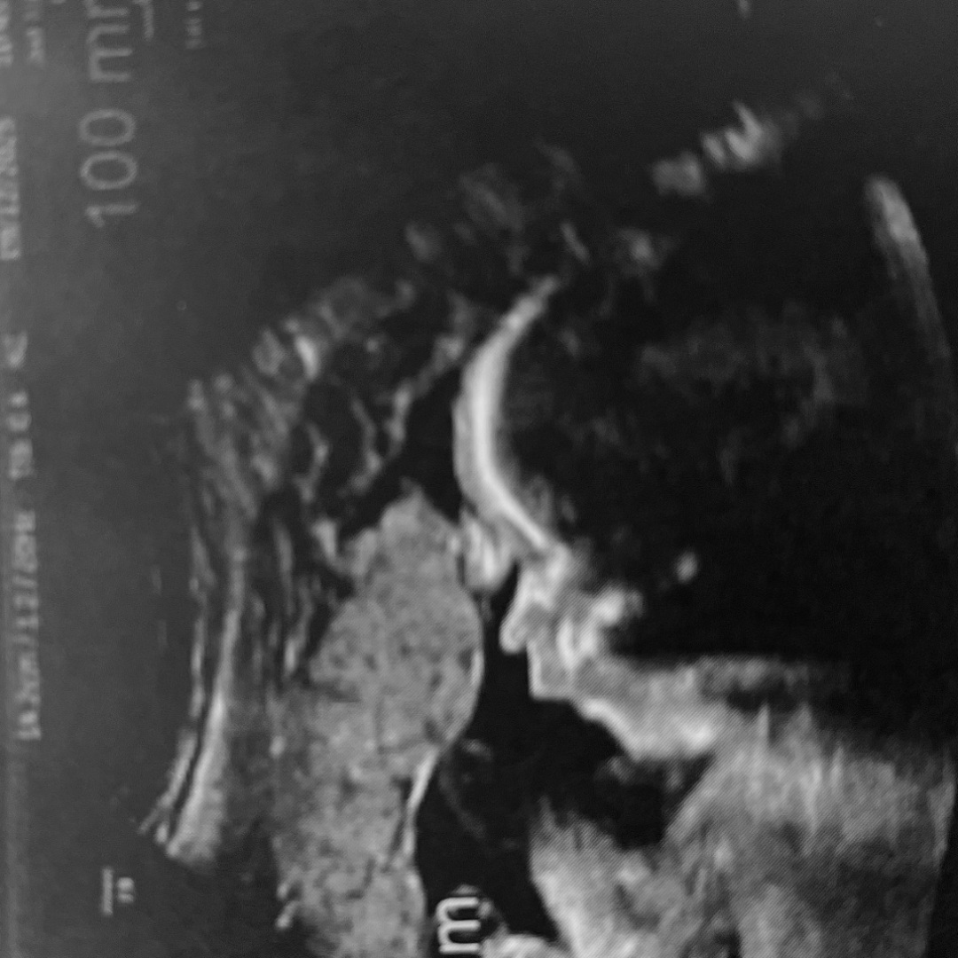 Photo shared by Brianna for their Babylist baby registry.