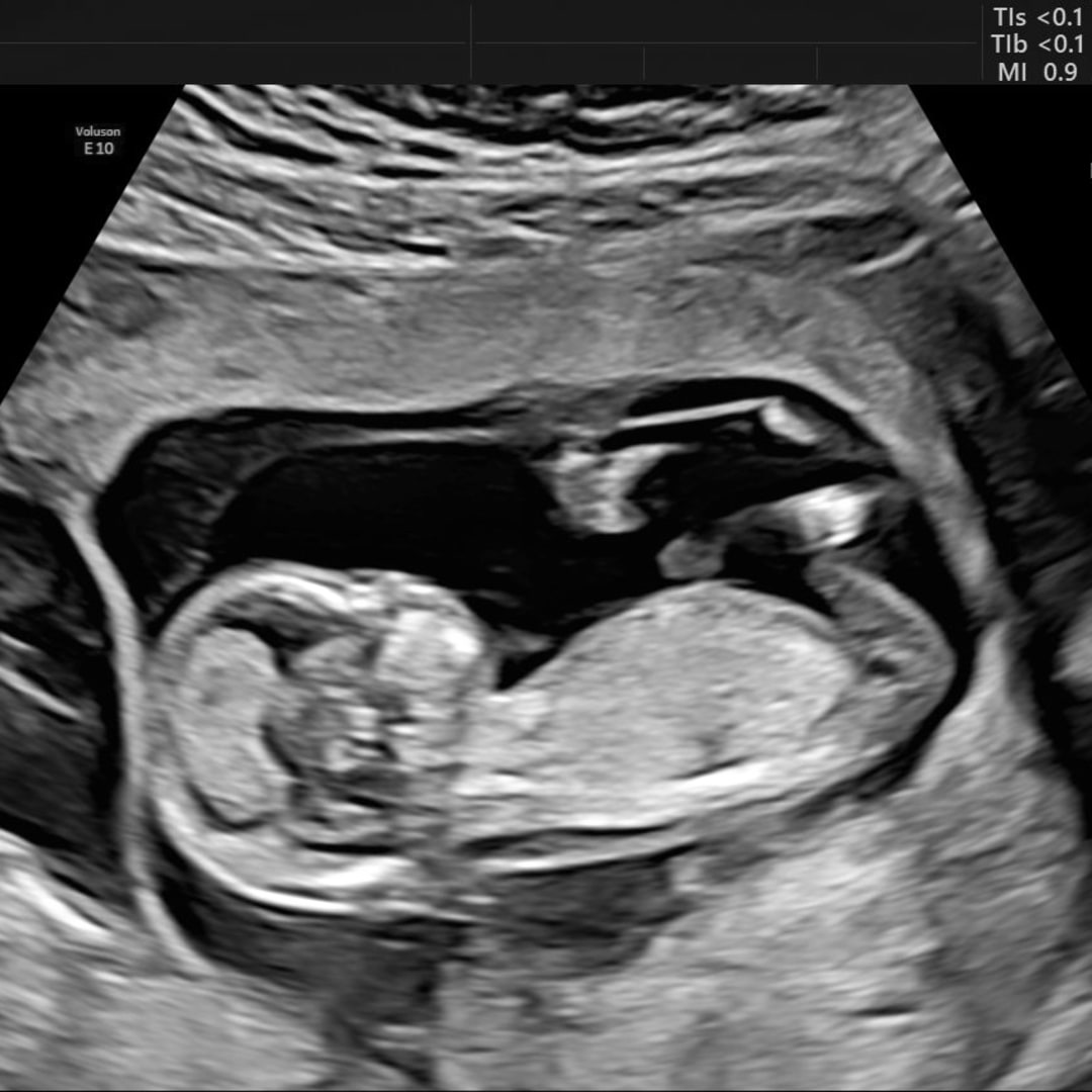 Photo shared by Gifany Ten-Ten for their Babylist baby registry.