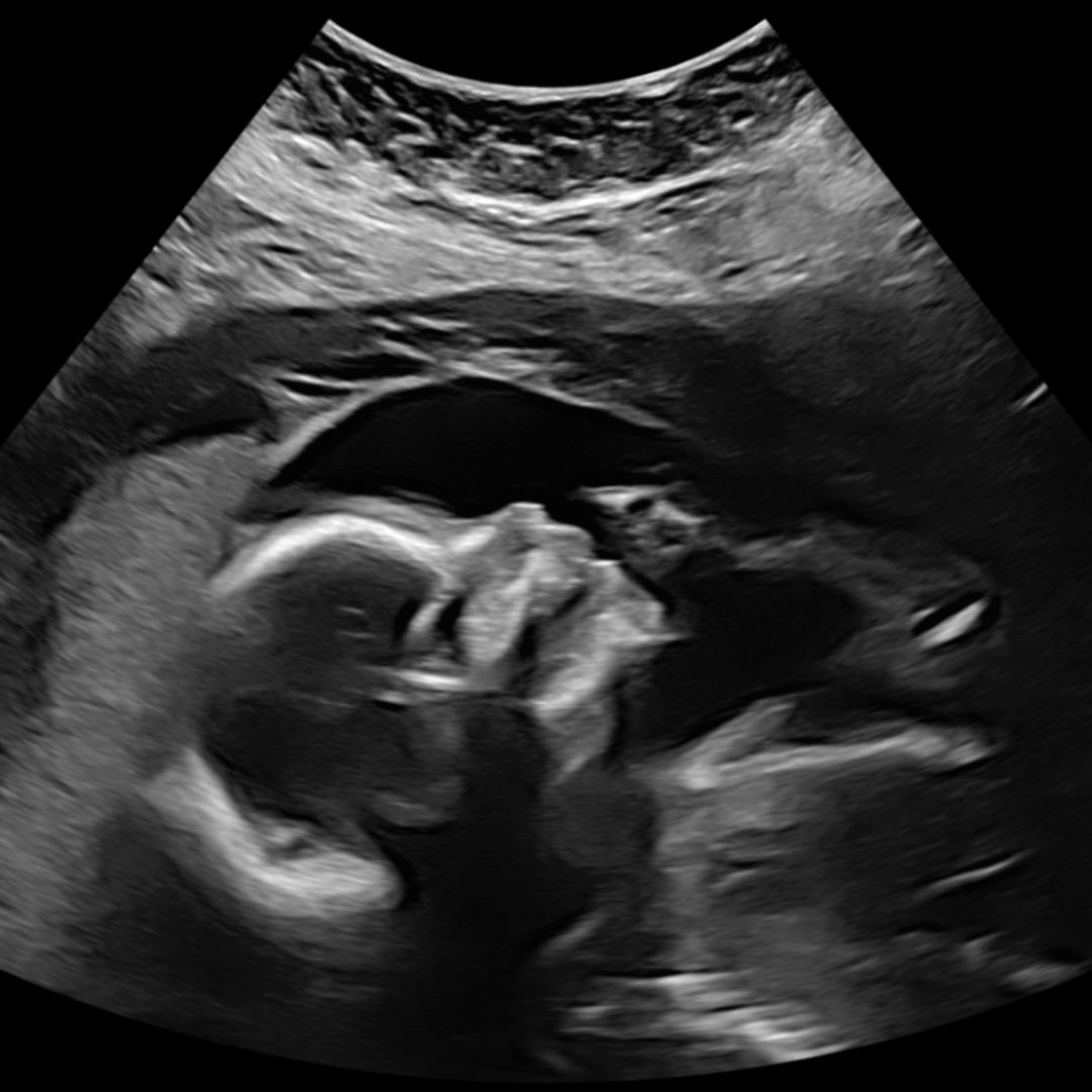 Photo shared by Makyla for their Babylist baby registry.