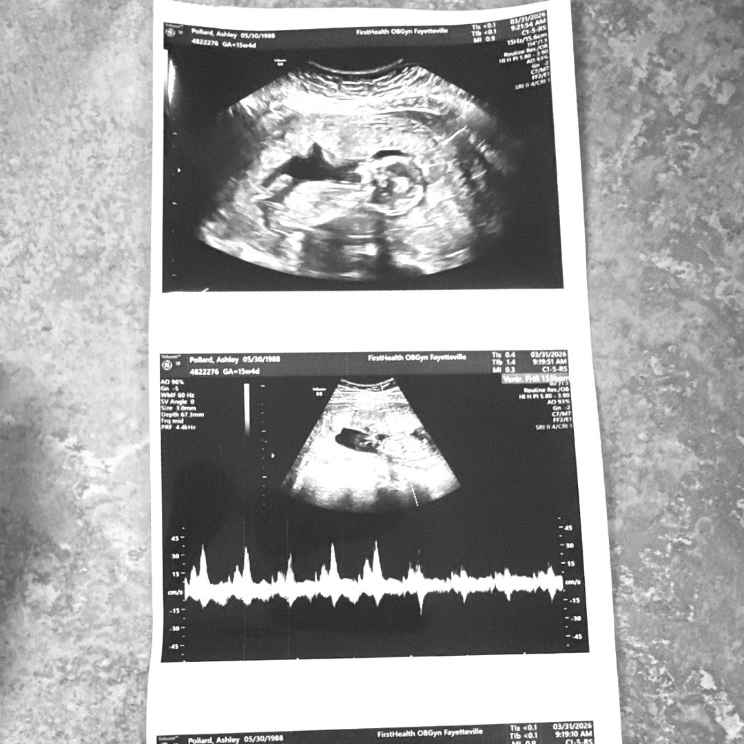 Photo shared by Ashley for their Babylist baby registry.