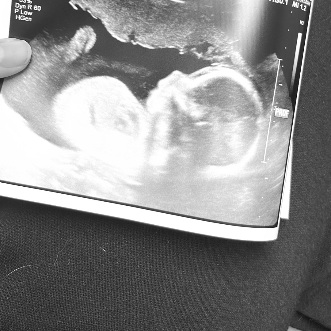 Photo shared by Jazmyne for their Babylist baby registry.