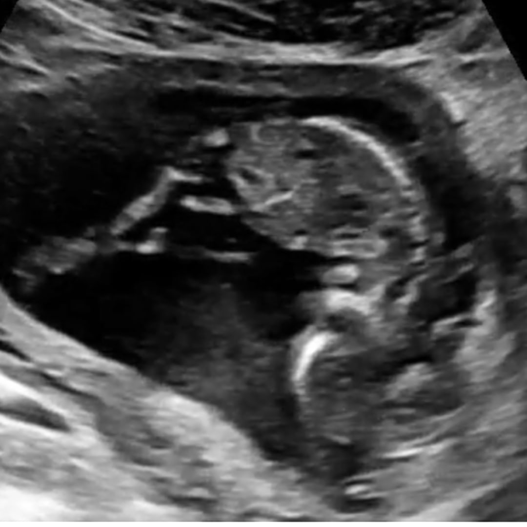 Photo shared by Karen for their Babylist baby registry.