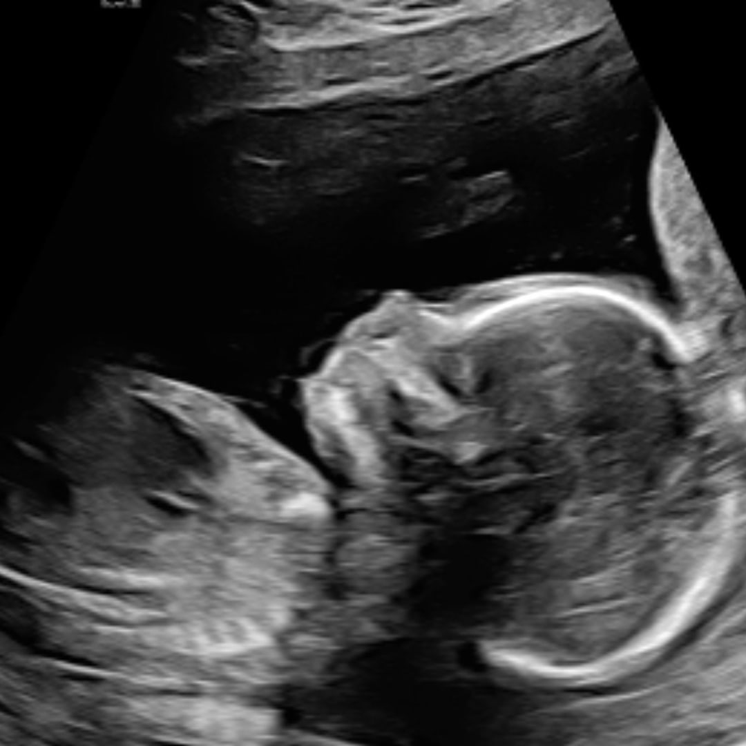 Photo shared by Eunice for their Babylist baby registry.