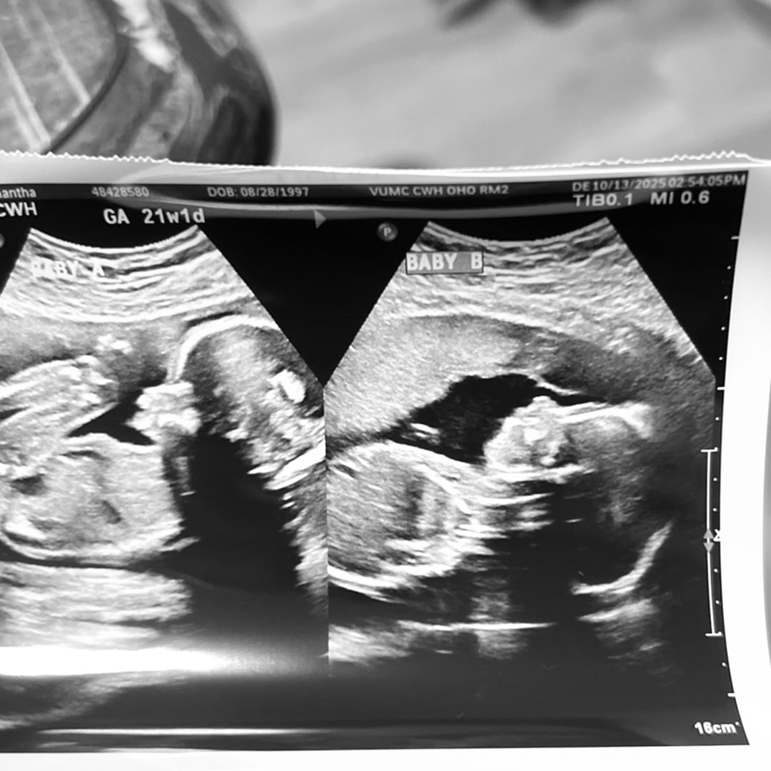 Photo shared by Samantha for their Babylist baby registry.