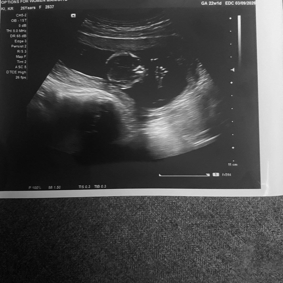 Photo shared by Krystynna for their Babylist baby registry.