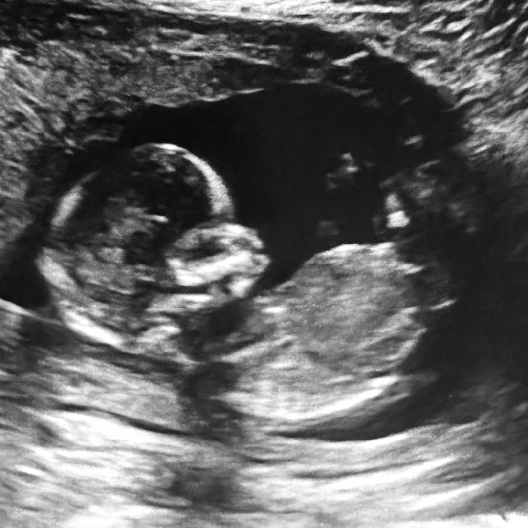 Photo shared by Shaley for their Babylist baby registry.