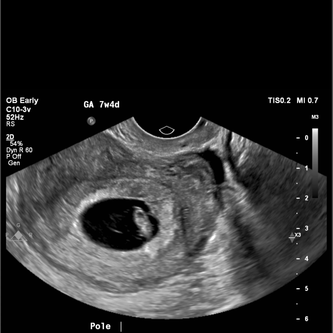 Photo shared by Angie and Jean for their Babylist baby registry.